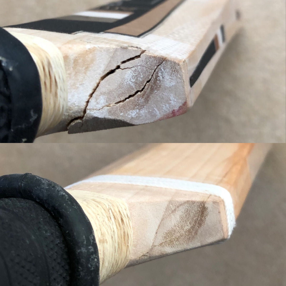 Shoulder Repair
